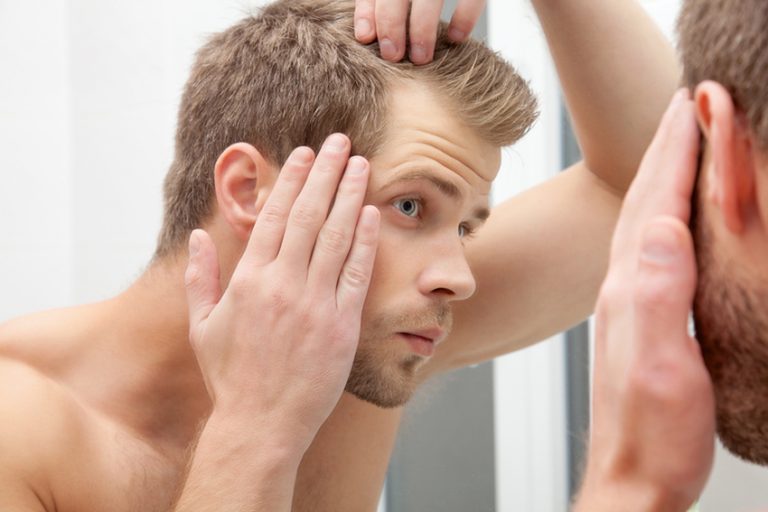 What Can I Do About Hair Loss?