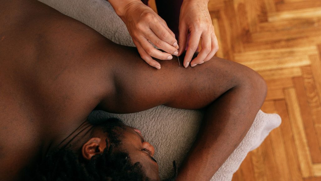 acupuncture for weight loss